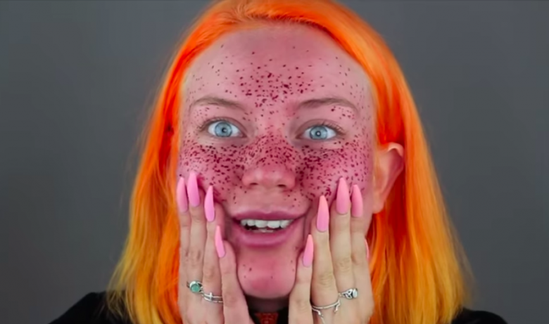 semi-permanent freckles