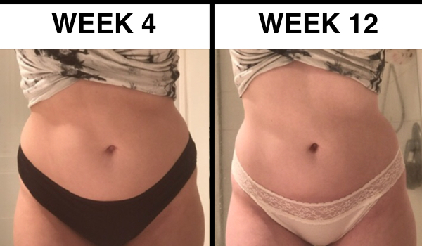 fat freezing results before after review